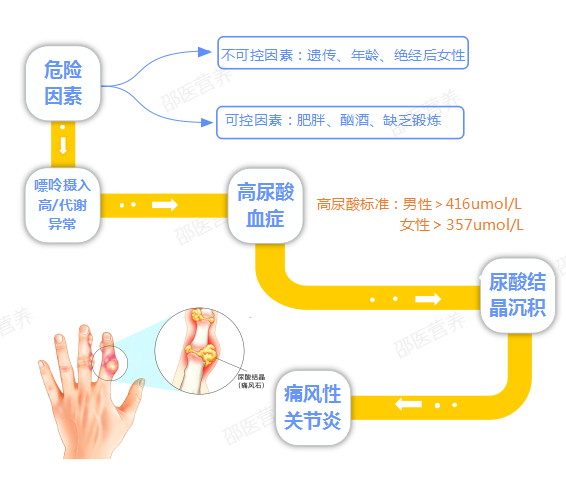 痛风为什么偏爱男性？你最关心的问题都在这里