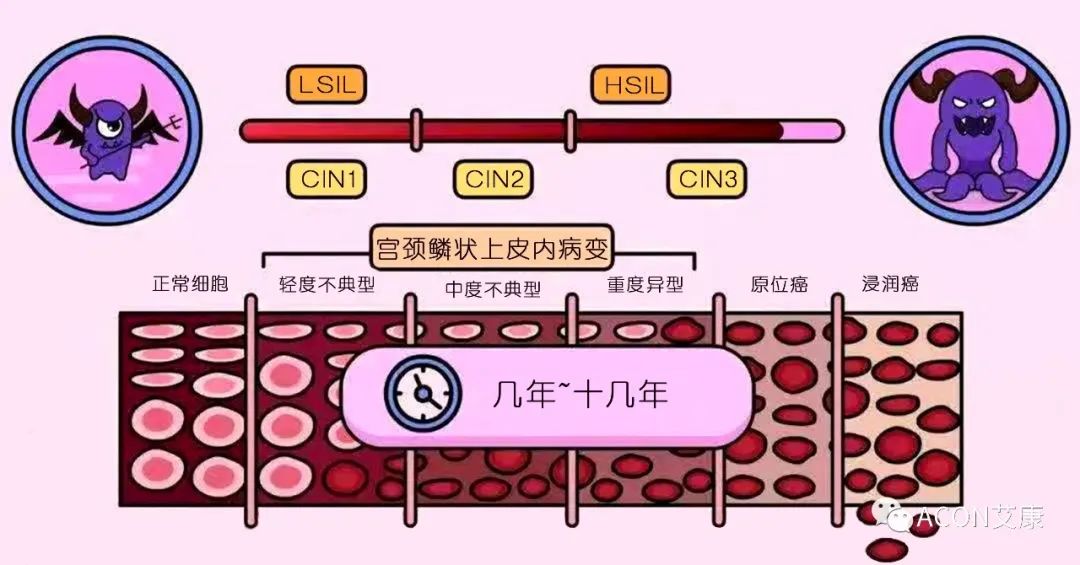 全球首次承诺消除一种癌症，预计到2050年将挽救500万人的生命