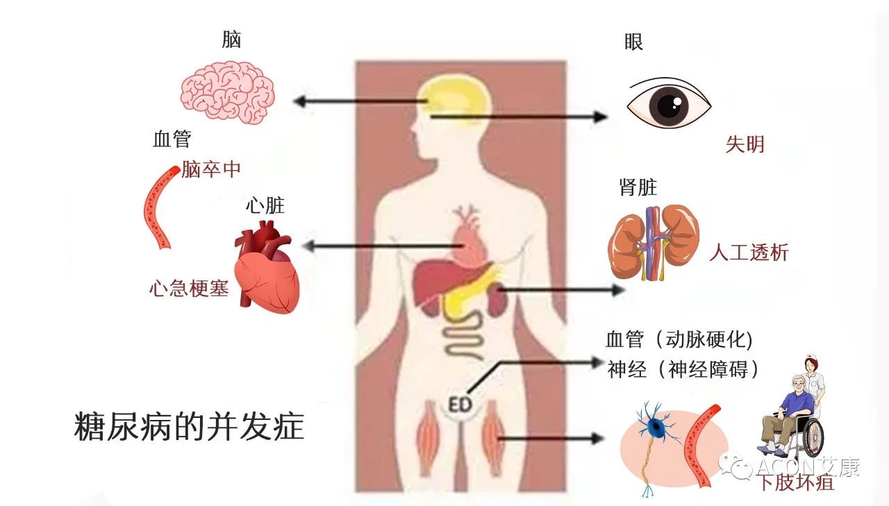 爆上热搜，因爆发型糖尿病进入ICU，有哪些教训值得我们汲取